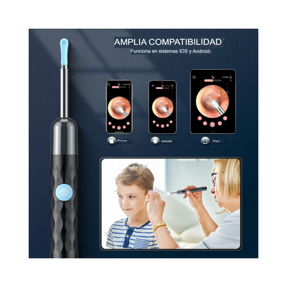 Cámara de Eliminación de Cerumen de Oído